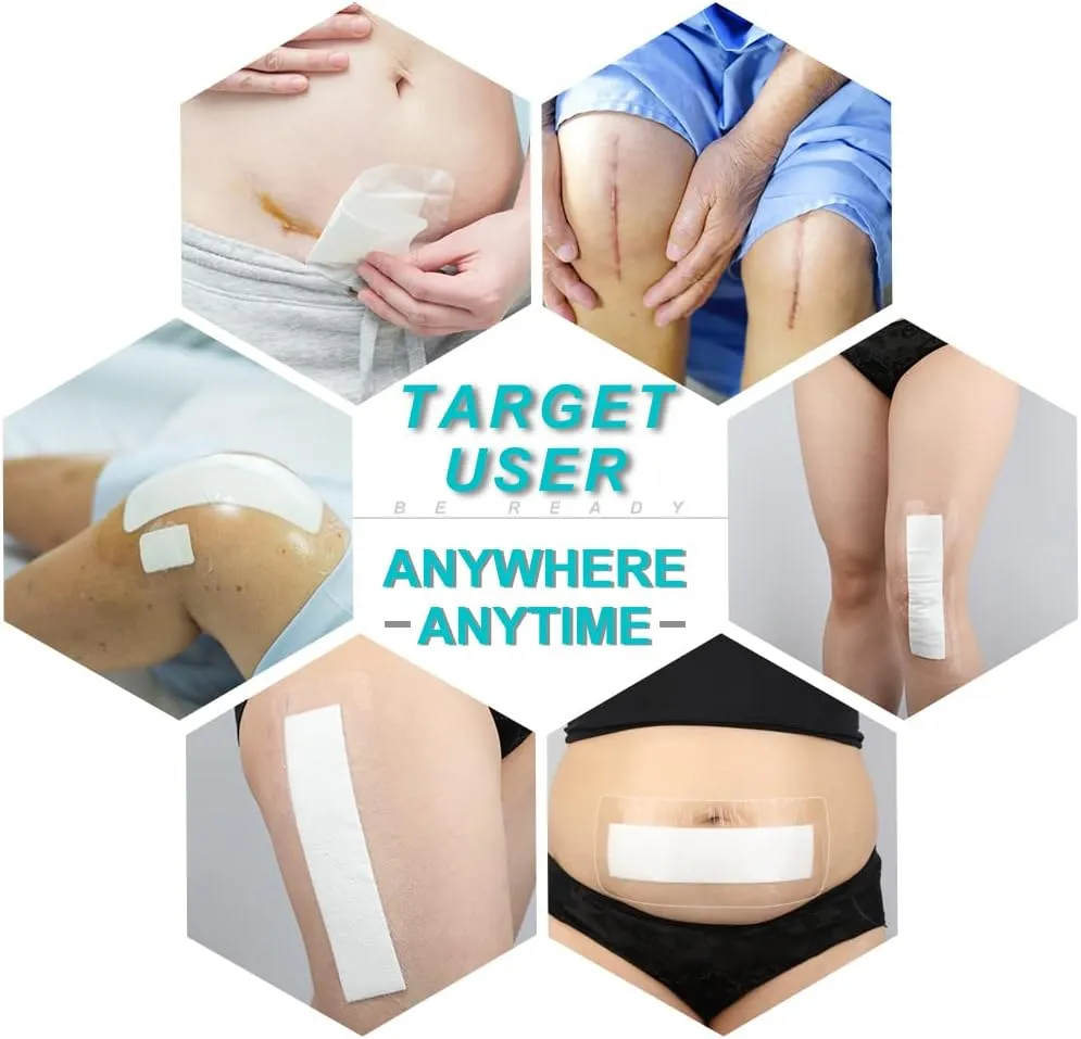Waterproof Knee Replacement Surgery Bandage | 4x8 Inch Shower Protector Island Dressing Pad Bordered Gauze | Hip Surgery Recovery Large Wounds Incision Cover with Adhesive Border (Pack of 25)